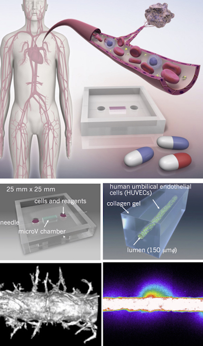 Microvessel model